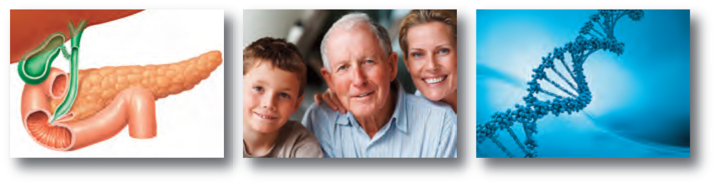 Diabetes mellitus - Typ 3 - spezifische Diabetes Typen - eine seltenere